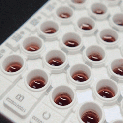Attosorb Technologie, DNS Extraktion aus Blut