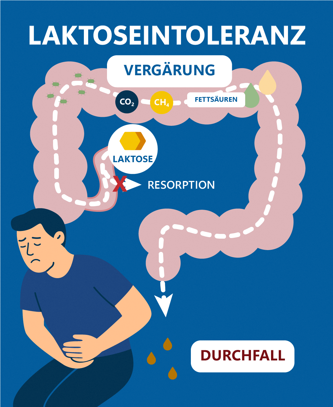 Infografik mit dem Pathomechanismus der Laktoseintoleranz. Bakterien verg&auml;ren unverdaute Lactose und es entstehen Methan, Kohlenstoffdioxid und kurzkettige Fetts&auml;ure. Ein Person h&auml;lt sich den Bauch, weil sie Bauchkr&auml;mpfe hat.